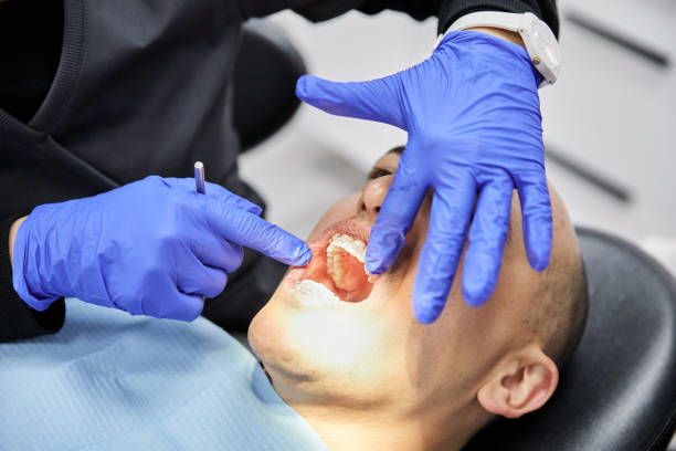 Best Emergency Tooth Extraction in Wellsboro, PA